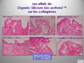 pitié-salpétrière-tests Collagene.jpg